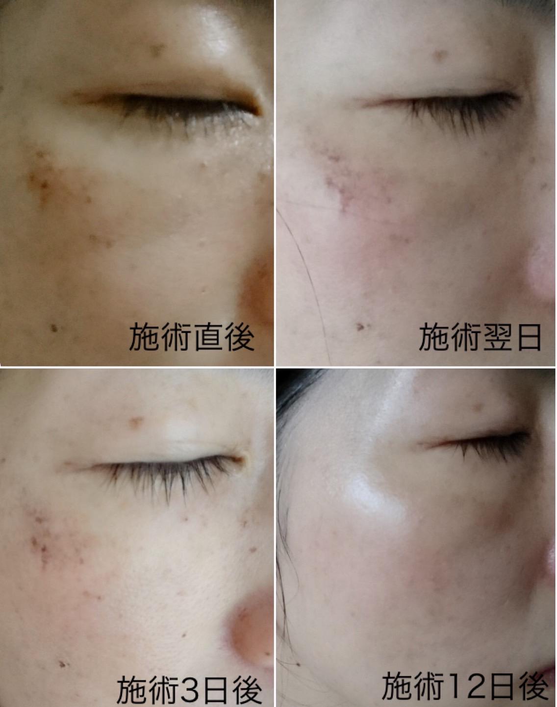 facial／ﾌｫﾄﾌｪｲｼｬﾙ