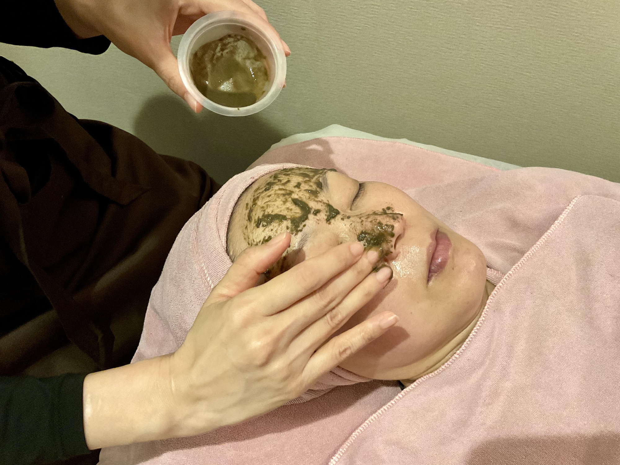 ヒト幹細胞で美肌に